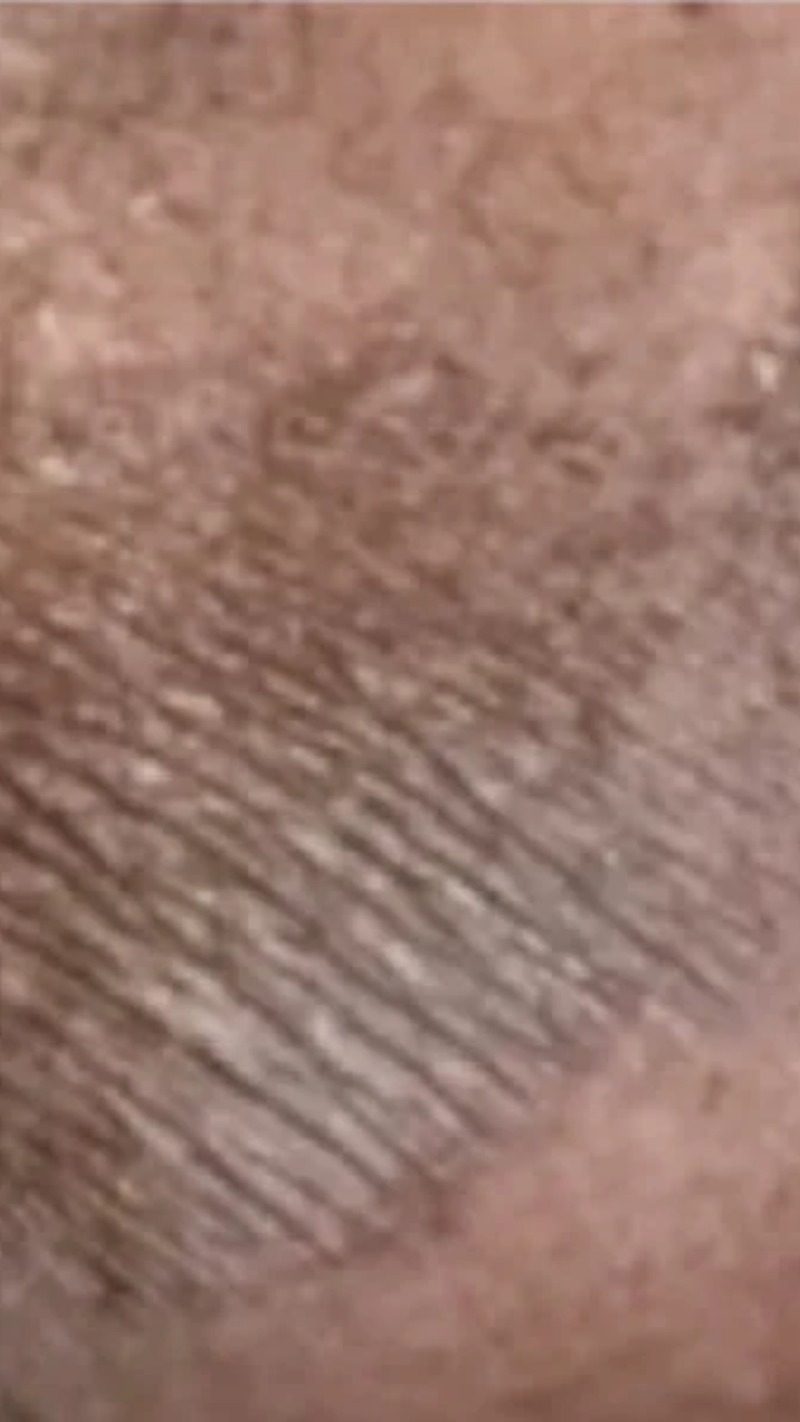Textura de la piel antes de usar el producto
