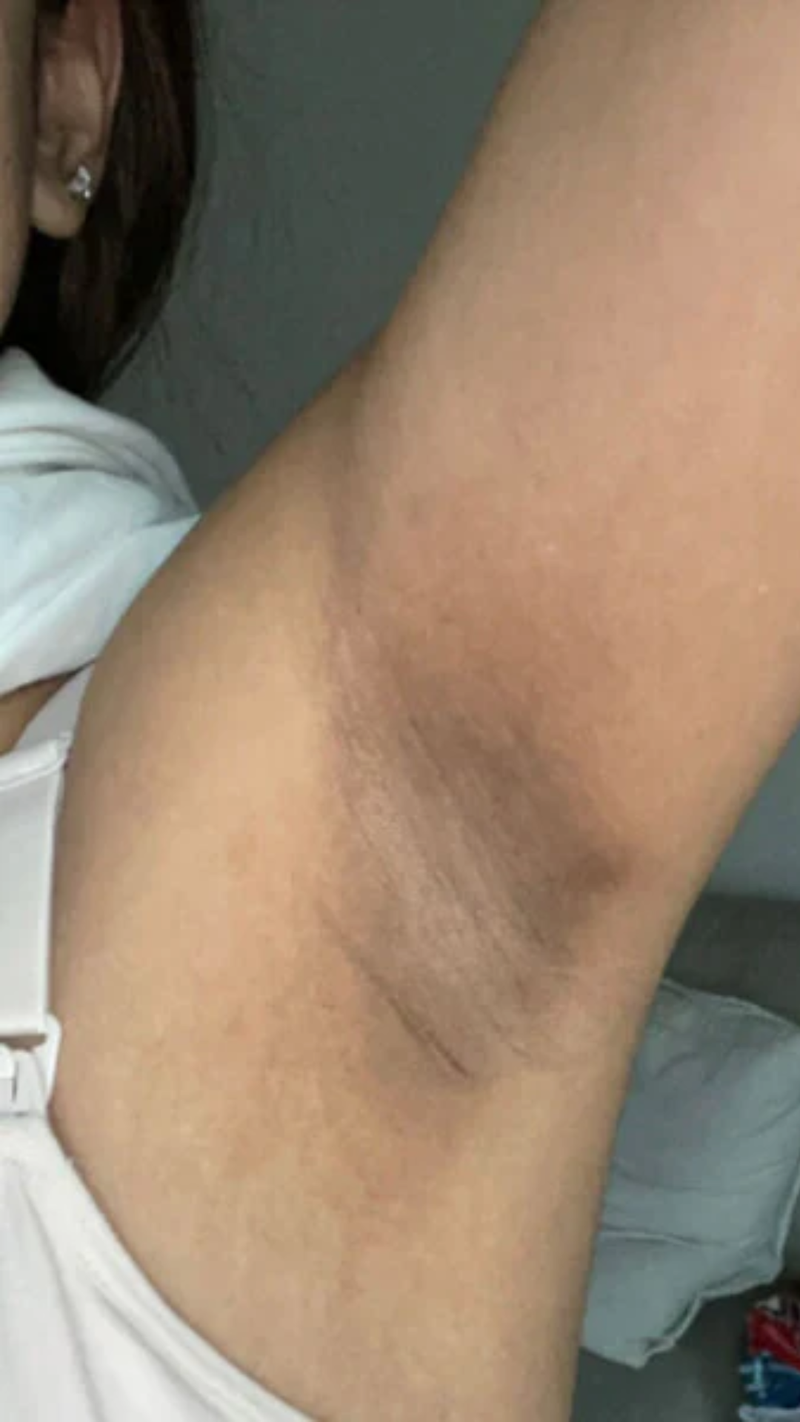 Textura de la piel antes de usar el producto